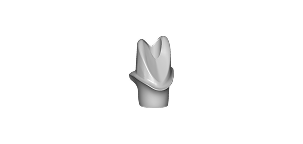 Custom Abutment